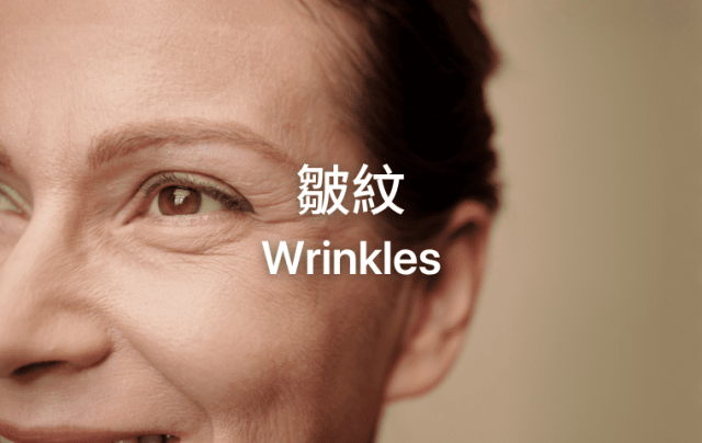 Wrinkles 皺紋